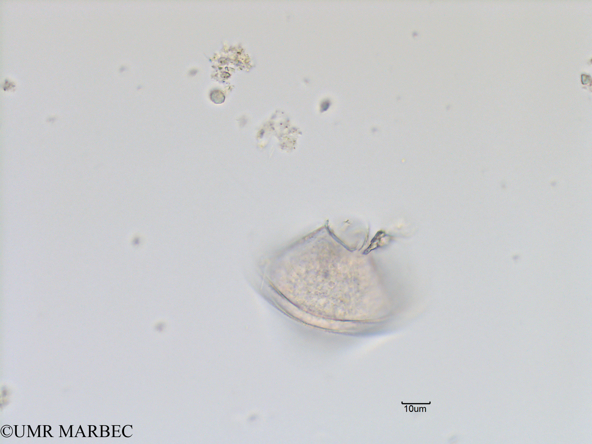 phyto/Bizerte/bizerte_lagoon/RISCO November 2015/Protoperidinium sp48 (Lagune_T1_B_Proto lequel).tif(copy).jpg